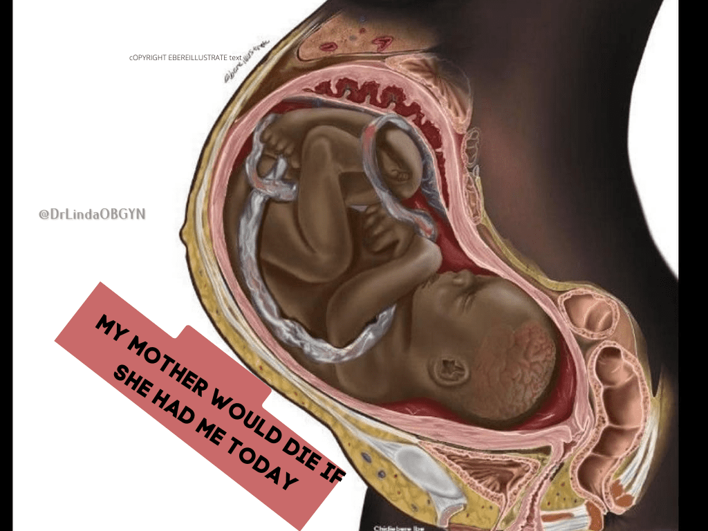 A drawing of the inside of a fetus with text.